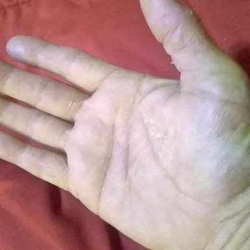 The palm of a woman's hand showing no signs of eczema after using goat milk soap