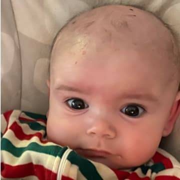 Little Baby Boy With Face Free of Eczema